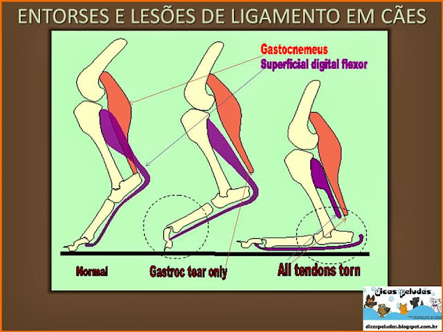 tratamento gastrocnêmio rasgado